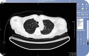 A CT scan displayed through tele-radiology.